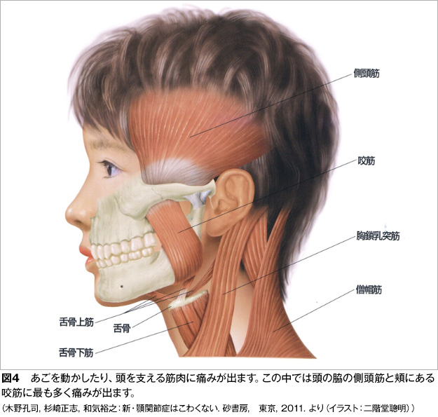 顎 と 首 が つながっ て いる 病気